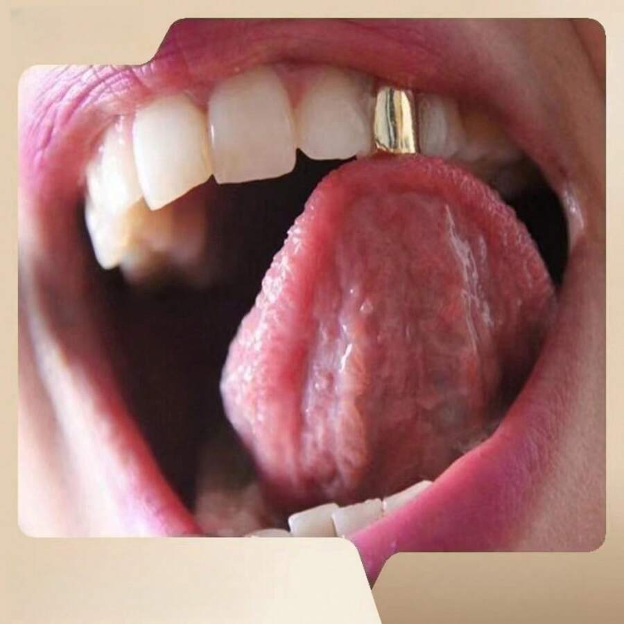 1入銀色單牙托,嘻哈風格單牙鍍金牙套適用於男女 - 銀色 - 查看 1