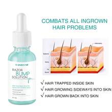 Prevent Ingrown Hair, Care For Smooth Skin! This Essence Inhibits Ingrown Hair And Effectively Reduces Ingrown Hair Problems With Professional Care. - Apricot - View 3