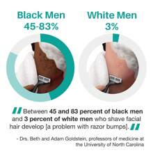 Prevent Ingrown Hair, Care For Smooth Skin! This Essence Inhibits Ingrown Hair And Effectively Reduces Ingrown Hair Problems With Professional Care. - Apricot - View 6