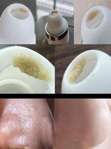 Instrumento de succión de espinillas, eliminación de acné en la nariz, eliminación de ácaros, eliminación de rostro - Blanco - Ver 1