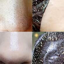 Leoyol 黑头去除鼻贴，深层清洁和清新肌肤，即时疏通毛孔，鼻贴 - 黑色 - 查看 5