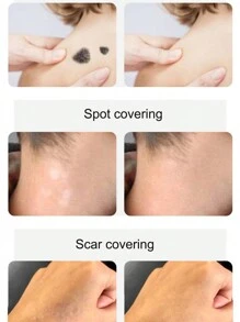 #01/8pcs/Set Tattoo Cover Up Tape, Skin Colored Scar Concealer, Suitable For Birthmarks, Vitiligo And Other Skin Conditions, Perfect For Light Skin. - Apricot - View 1