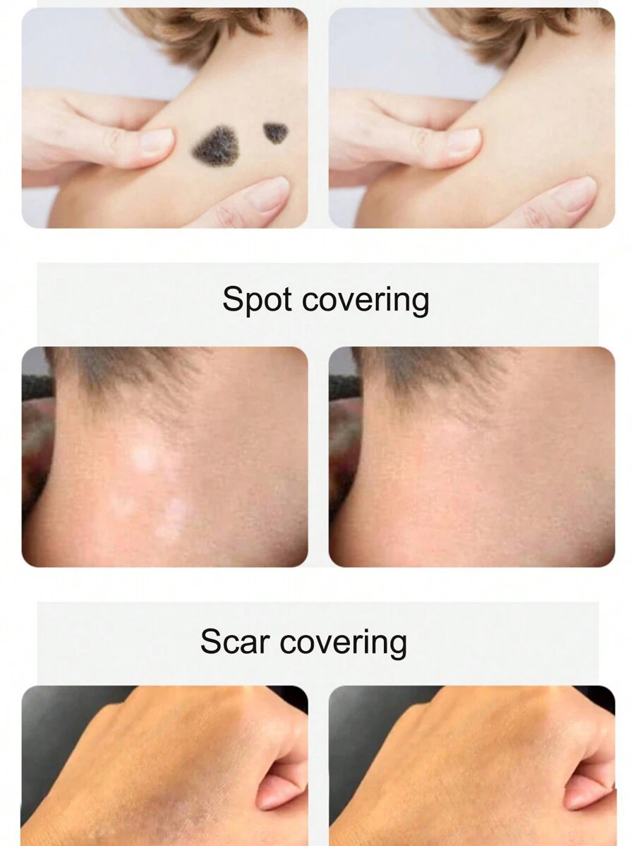 #01/8pcs/Set Tattoo Cover Up Tape, Skin Colored Scar Concealer, Suitable For Birthmarks, Vitiligo And Other Skin Conditions, Perfect For Light Skin. - Apricot - View 1