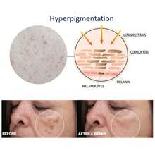 薑黃美白修正精華液,提亮膚色,滋潤並滋養肌膚,含有薑黃提取物、維生素c、甘油、卡波姆、橄欖油；適用於女孩和女性 - 30ml - 查看 4