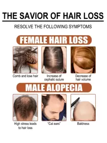 OIL FOR HAIR LOSS Strengthening Oil For Fine Hair | Deep Nourishing Treatment For Growth - Multicolor - View 3