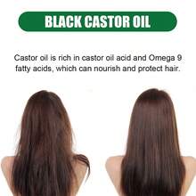 1入組蓖麻油生髮精華素 (黃色,60毫升) 配2支梳子,強化頭髮根部,修復損壞頭髮,滋潤乾燥髮尾,增強頭髮彈性,改善頭髮密度,促進生髮油 - 黃色 - 查看 4