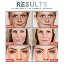 1pc 30ml Eelhoe Anti-Aging Cream Reduces Fine Lines Wrinkles, Repairs, Tightens, Moisturizes, And Restores The Skin - White - View 6