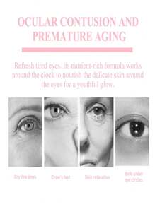 1pc 3g Eelhoe Retinol Eye Cream Stick, Moisturizing & Firming & Anti-Aging & Portable - White - View 2