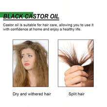 1入組蓖麻油生髮精華素 (黃色,60毫升) 配2支梳子,強化頭髮根部,修復損壞頭髮,滋潤乾燥髮尾,增強頭髮彈性,改善頭髮密度,促進生髮油 - 黃色 - 查看 3