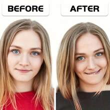 Dimple Maker Facial Dimple Training Device, Natural Dimples, Easy To Wear, Face Muscle Training, Gift For Girls, Girlfriend(Women) - Blue - View 4