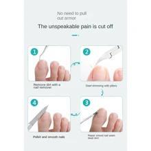 【適用於老年人趾甲厚的情況】足部護理剪刀和指甲刀套裝,鷹喙鉗子設計用於治療剝繭,厚趾甲和內陷趾甲 - 彩色 - 查看 2