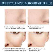 60 件蛋白质提升线，抗皱，抗衰老，淡化细纹，保湿，面部提升，塑形 - 白色 - 查看 6