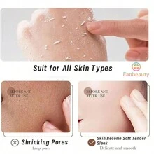 2 Piezas de Exfoliante De Arroz Para Aclarar La Piel, Exfoliante De Arroz Para El Cuerpo, Crema De Arroz Para Blanquear La Piel, Gel Exfoliante Blanquear La Piel, Exfoliante De Arroz Para Aclarar La Piel, Exfoliante Para El Cuerpo,Crema Para Aclarar Las Axilas Exfoliante De Arroz Para Aclarar La Piel   Gel Exfoliante De Extracto De Planta De Arroz ,xfoliante para aclarar el Rostro | Gel Exfoliante de arroz hidratante de 4.7 oz, Exfoliante Limpiador | Exfoliante Limpiador de Cuerpo Completo para Mujeres de Cualquier Tipo de Pie - Beis - Ver 6