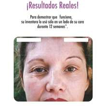 Máquina de Radiofrecuencia Facial Anti Arrugas, Portátil Reafirmante, Rejuvenecimiento Facial, Tratamiento de Radio Frecuencia Facial en el hogar. Dispositivo - Morado - Ver 6