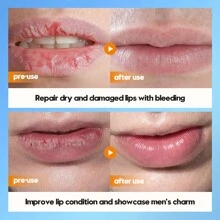 男士潤唇膏 - 男士唇部保濕霜 - 男士唇部護理,適合乾燥、乾裂的嘴唇,角鯊烷、維生素 E（2 件） - 裸色 - 查看 2