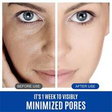 Collagen Cream For Face With Retinol And Hyaluronic Acid, Day And Night &  Skincare Facial Moisturizer