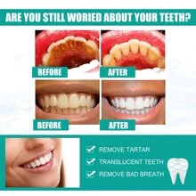 Pasta De Dientes Blanqueadora Antibacterias De Cuidado Dental, Eliminadora De Manchas Y De Placa Para Una Higiene Oral Profunda, Aliento Fresco Y Brillante 50g En 5 Días - Blanco - Ver 7