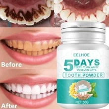 Pasta De Dientes Blanqueadora Antibacterias De Cuidado Dental, Eliminadora De Manchas Y De Placa Para Una Higiene Oral Profunda, Aliento Fresco Y Brillante 50g En 5 Días - Blanco - Ver 2