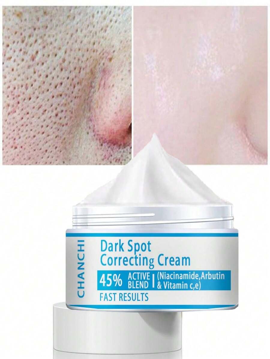 5G/15G/30G/50G/100G美白雀斑霜去除黄褐斑淡化黑斑亮白黄褐斑去除剂保湿抗衰老面部护理