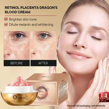 O'CHEAL Ocheal Hyaluronic Acid, Retinol, Dragon'S Blood Cream For Moisturizing, Firming And Anti-Aging - Multicolor - View 1