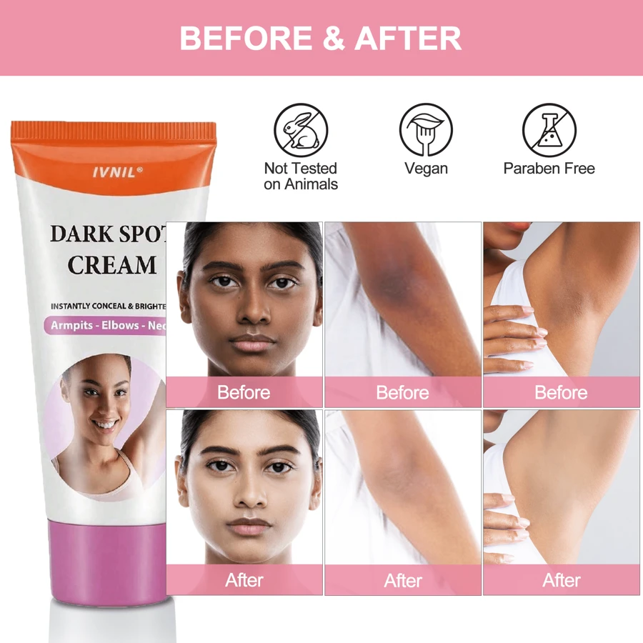 Skin Lightening Cream, Skin Bleaching Cream For Intimate Area