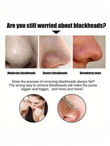 Mascarilla de carbón de bambú para eliminación de puntos negros, mascarilla de limpieza profunda para manchas en la nariz, mascarilla para la nariz, dolor de acné y puntos negros - Negro - Ver 3