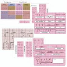 EKG Cardiac Badge Card 3 Card Set, Stemi Badge Card EKG Telemetry ...