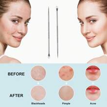 Professional Acne Removal Tool Kit, Blackhead Extractor, Pimple Popper, Comedone Extractor, Stainless Steel Acne Remover Tweezers, With Loop Facial Tool For Removing Blackheads - Silver - View 8