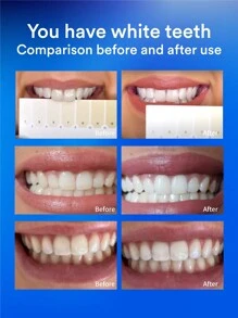 Hismile LED Teeth Whitening Gel Refill,6 X 4.2ml Gel Ampoule - White - View 7