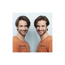 Nioxin Kit System 2 - 150ml Shampoo, 150ml Conditioner + 50ml Scalp Treatment - White - View 12
