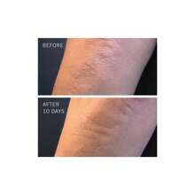 First Aid Beauty KP Bump Eraser Body Scrub With 10% AHA - 283.5g - White - View 4