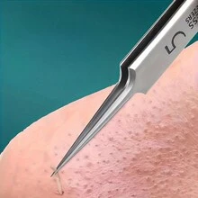 8pcs Blackhead Remover Kit, Pimple Extractor Tool Set For Blemish, Whitehead, Comedone, Acne Removal On Face And Nose - White - View 3