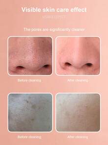 1入組5頭款鑽石磨皮毛孔吸塵黑頭清潔器家用深層清潔設備 - 白色 - 查看 3