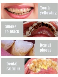 Ultrasonic Tooth Cleaner, Battery-Powered(Excluding Battery) - Black - View 6