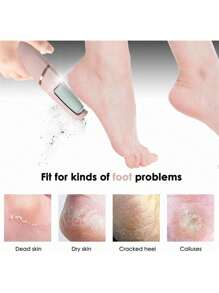 Rechargeable Electric Callus Remover Exfoliation Pedicure Foot File With Double File Two Speeds Light Included USB Charger Foot Care - Baby Pink - View 3
