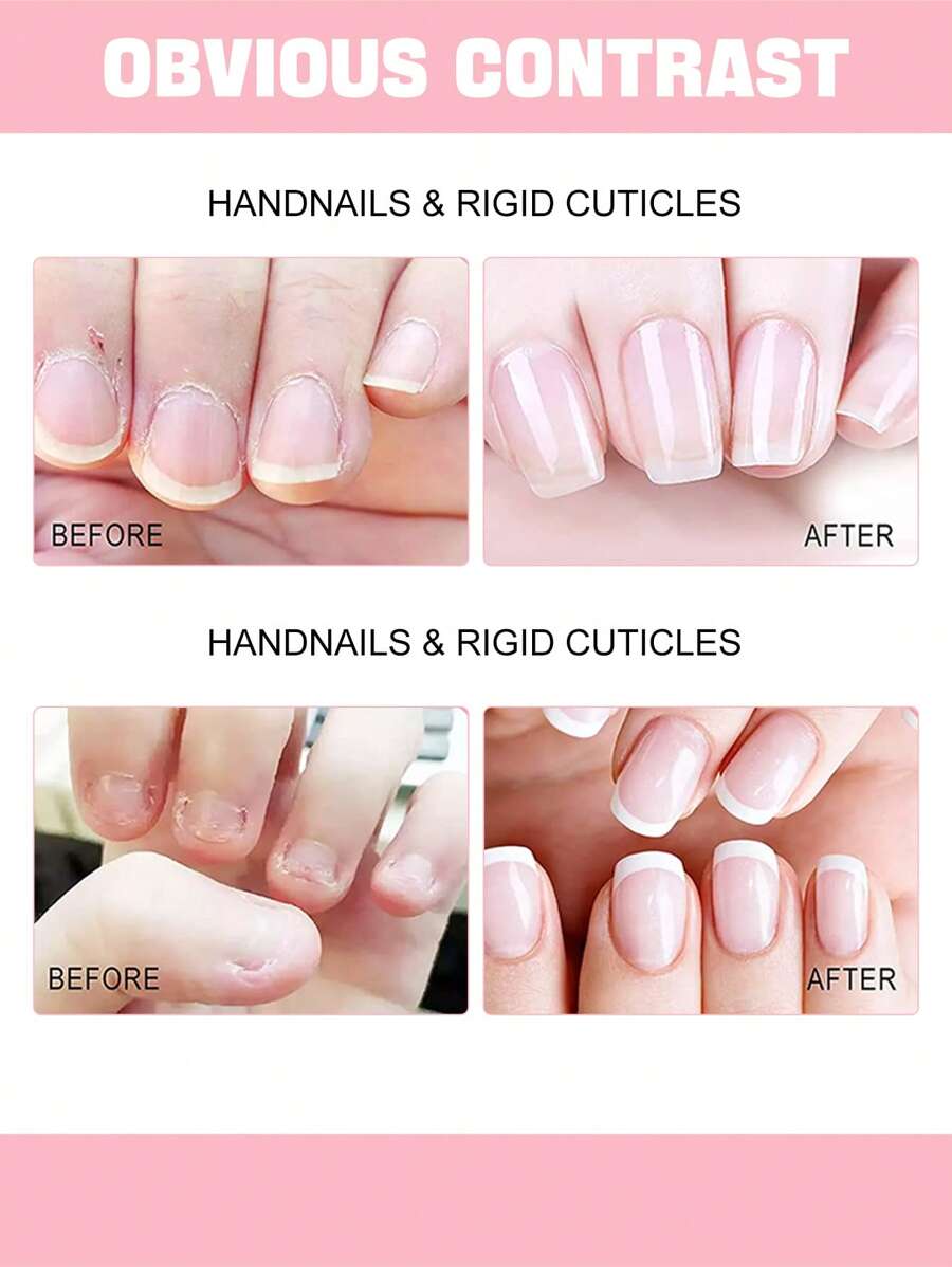 Cuticle Oil - Hydrating Oil For Repaired Cuticles Overnight - Remedy ...
