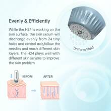 Portable Derma Roller Hydra Roller Microneedle Roller And Microinfusion Serum Applicator For Face Body Beauty Roller For Skincare With Liquid-Load Bottle - White - View 3