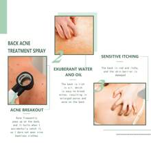 120ml 背部和手臂痤瘡修復噴霧-淡化痤瘡疤痕,潔淨和平滑背部、肩膀和身體的皮膚 - 綠色 - 查看 2