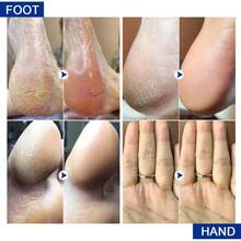 Crema De Pie De Queratina Para Eliminación De La Piel Muerta De Los Pies, Agrietamiento De Uñas Y Talón, Tratamiento Humectante Y Exfoliante, Cremas De Manos Para Cuidado De La Piel De La Salud Y La Belleza - Albaricoque - Ver 5