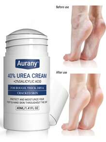 AURANY Crema De 42% De Urea Baja Alergénica En Palo - Crema De Urea 40% Para Pies + Ácido Salicílico Del 2% De Hidratación Y Nutrición Profunda, Adecuado Para El Cuidado De Manos, Pies Y Talones, Suavizando La Piel Seca Y Áspera, Adecuado Para Todo Tipo De Piel - Blanco - Ver 1