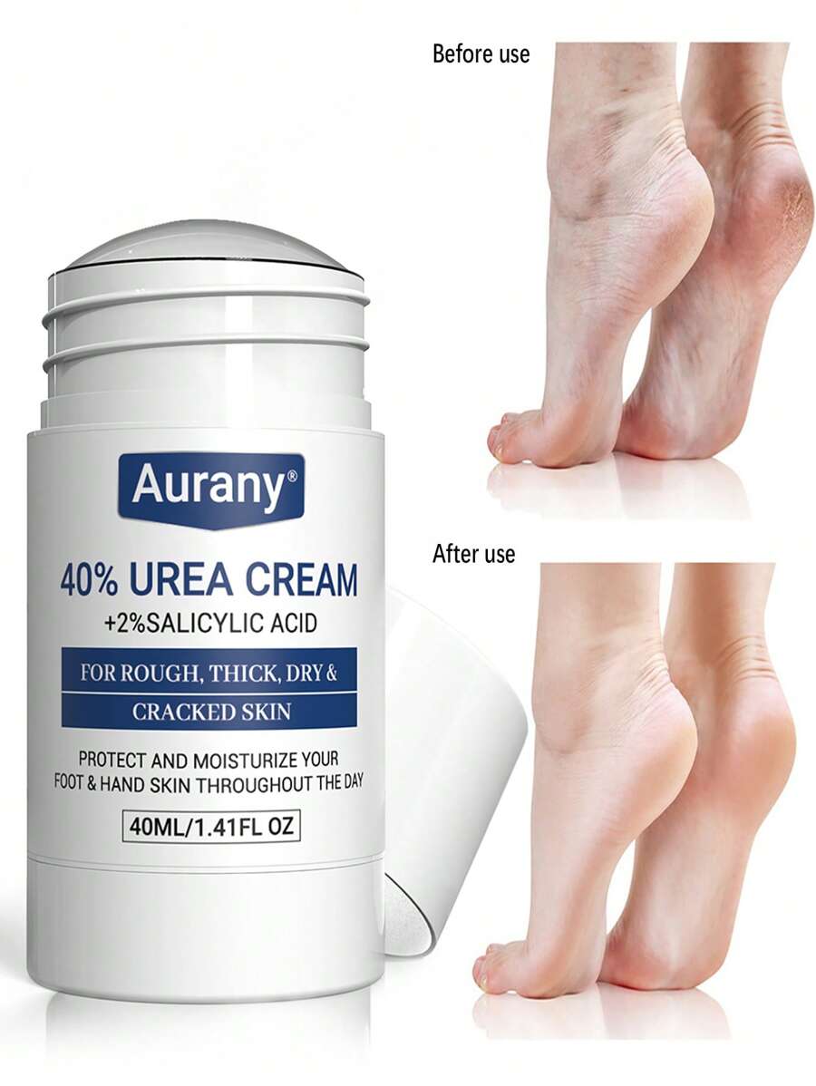 AURANY Crema De 42% De Urea Baja Alergénica En Palo - Crema De Urea 40% Para Pies + Ácido Salicílico Del 2% De Hidratación Y Nutrición Profunda, Adecuado Para El Cuidado De Manos, Pies Y Talones, Suavizando La Piel Seca Y Áspera, Adecuado Para Todo Tipo De Piel - Blanco - Ver 1