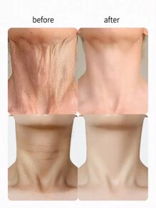 淡化細紋、防止皺紋、滋潤、緊實和光滑肌膚,有效修復頸紋 - 彩色 - 查看 5