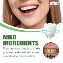 美白牙膏，小蘇打牙膏，泡沫美白牙膏，清新口氣深度潔淨牙齒，去除污漬，男女均適用，超細膩泡沫深度清潔和去污