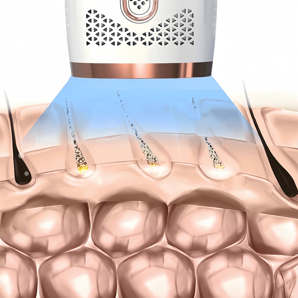 ( UKplug )Painless Epilator,Laser Hair Removal Device, IPL Hair Removal