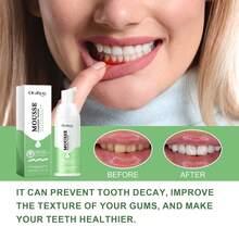 美白牙膏，小蘇打牙膏，泡沫美白牙膏，清新口氣深度潔淨牙齒，去除污漬，男女均適用，超細膩泡沫深度清潔和去污