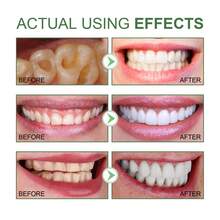 美白牙膏，小蘇打牙膏，泡沫美白牙膏，清新口氣深度潔淨牙齒，去除污漬，男女均適用，超細膩泡沫深度清潔和去污