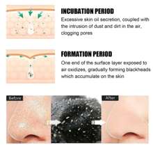 mascarilla liquida para retirar espinillas tratamiento de 3 pasos limpiador de puntos negros granos y espinillas de tu nariz - Multicolor - Ver 7