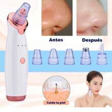 1 Pieza Removedor De Espinillas Eléctrico Recargable De 150 Mah, Extractor De Granos, Limpiador De Poros Faciales Con Dispositivo De Belleza De Microcristalina Para Uso En El Hogar