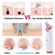 1 Pieza Removedor De Espinillas Eléctrico Recargable De 150 Mah, Extractor De Granos, Limpiador De Poros Faciales Con Dispositivo De Belleza De Microcristalina Para Uso En El Hogar