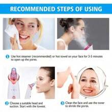 1 Pieza Removedor De Espinillas Eléctrico Recargable De 150 Mah, Extractor De Granos, Limpiador De Poros Faciales Con Dispositivo De Belleza De Microcristalina Para Uso En El Hogar